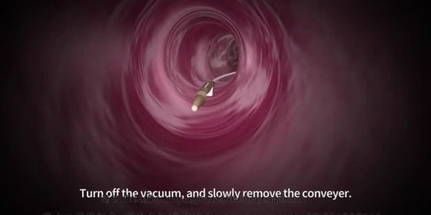 医疗器械产品记录器内窥设备手术过程