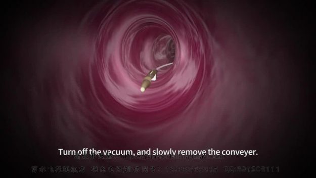 医疗器械产品记录器内窥设备手术过程