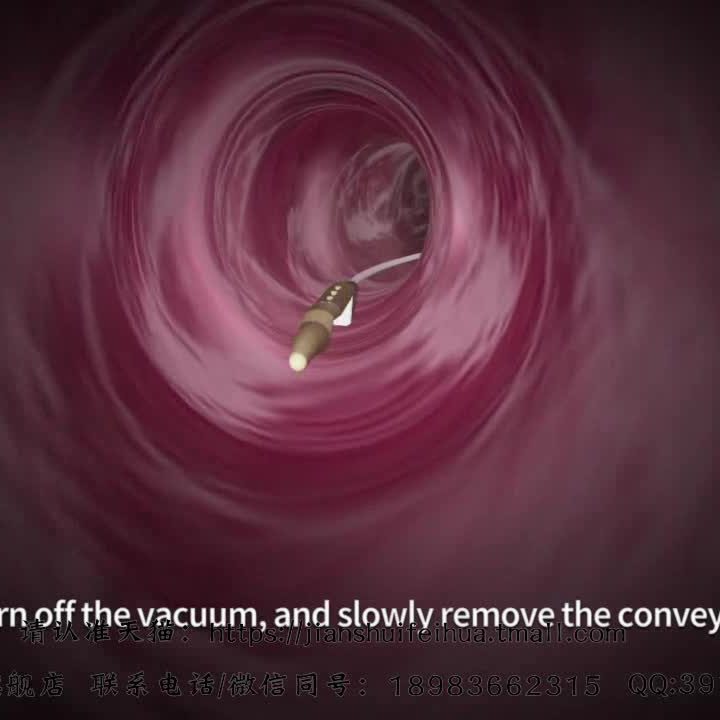 医疗器械产品记录器内窥设备手术过程